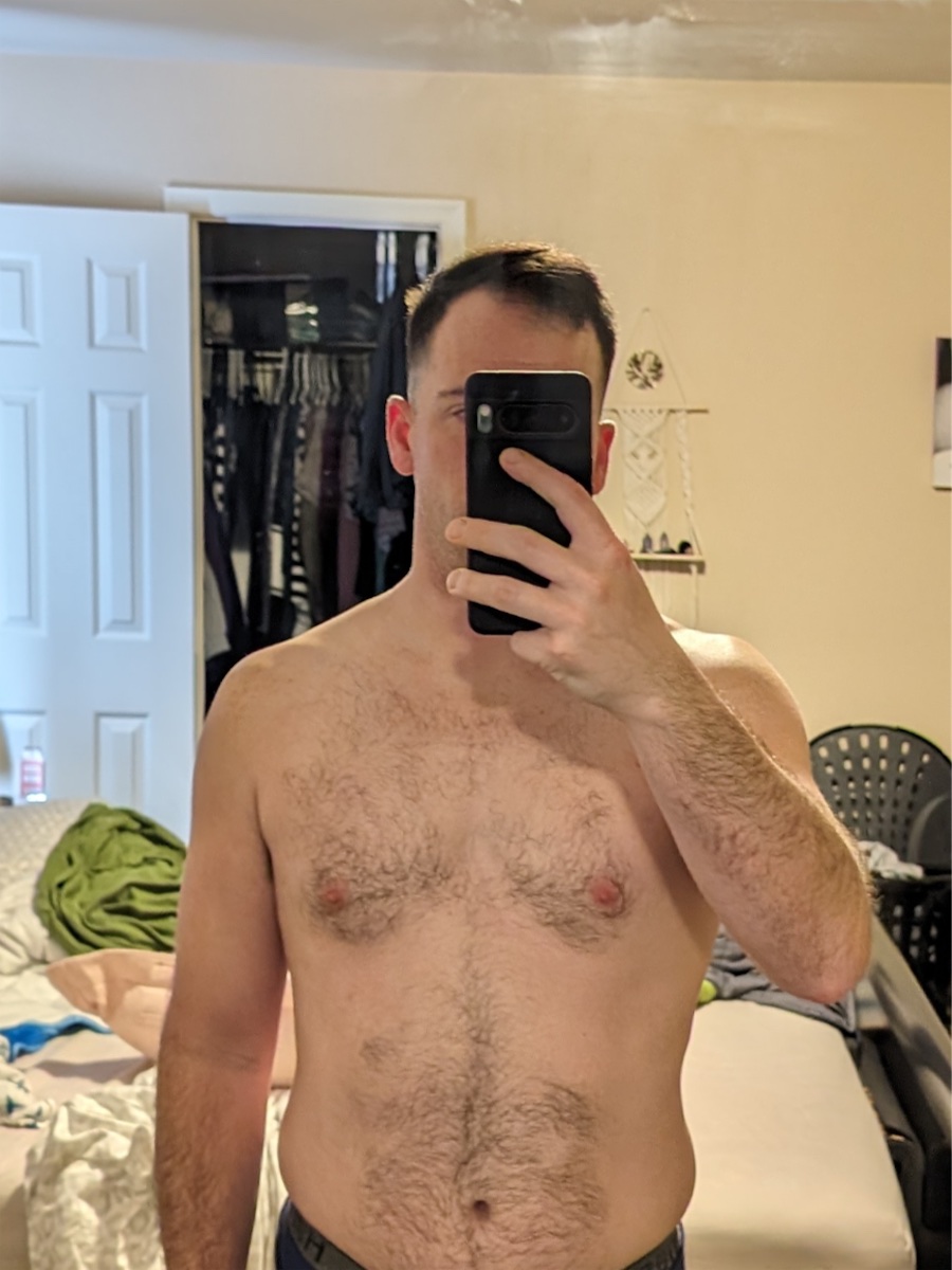 Matt before